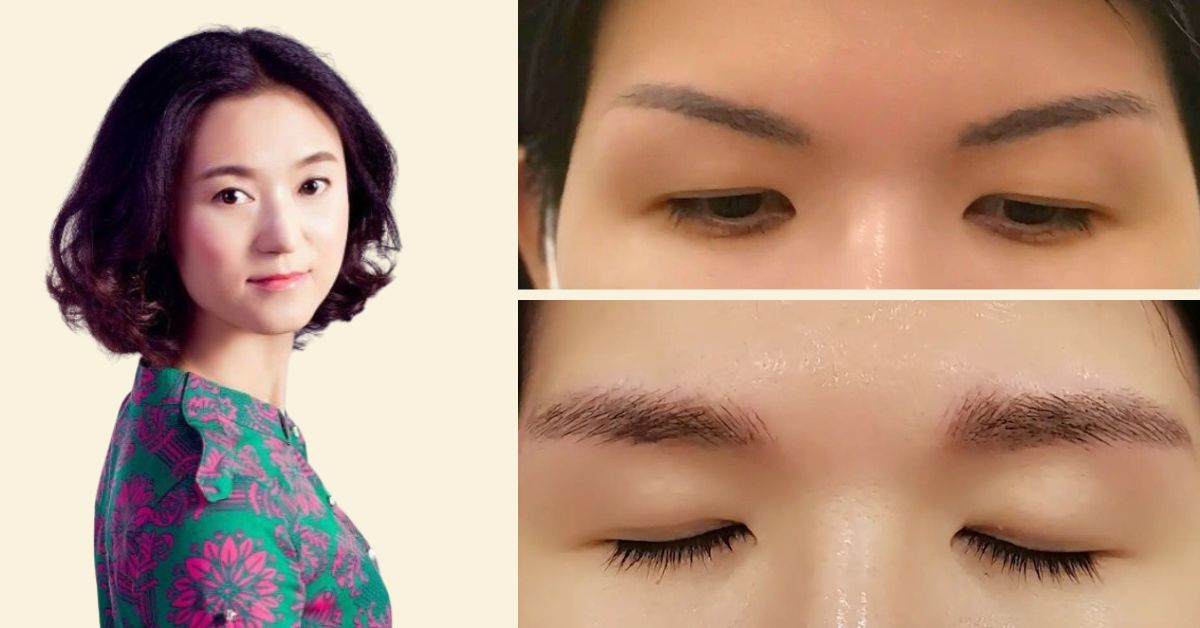 Top Places for Eyebrow Embroidery Removal in Singapore